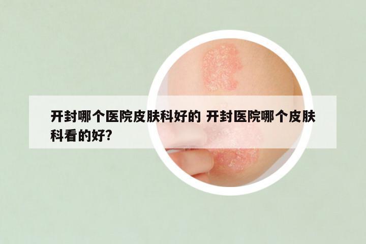 开封哪个医院皮肤科好的 开封医院哪个皮肤科看的好?
