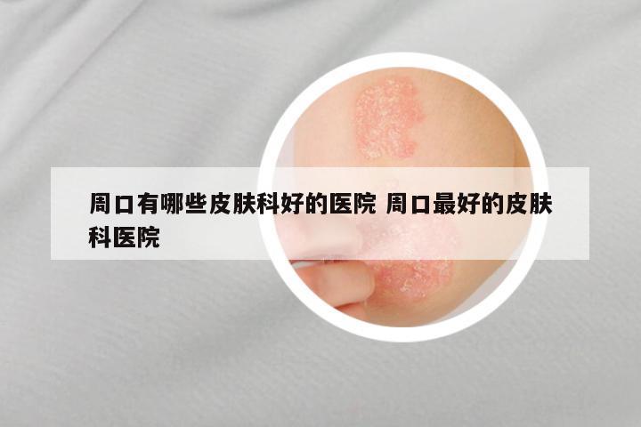 周口有哪些皮肤科好的医院 周口最好的皮肤科医院
