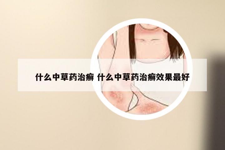 什么中草药治癣 什么中草药治癣效果最好