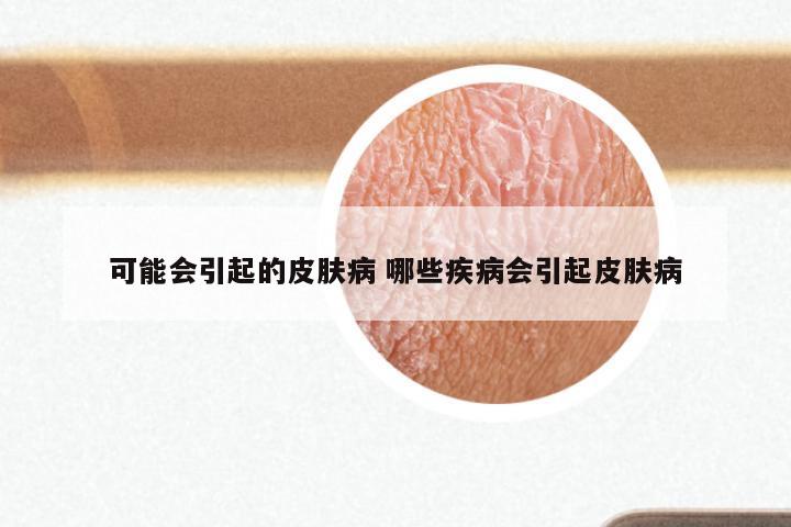 可能会引起的皮肤病 哪些疾病会引起皮肤病