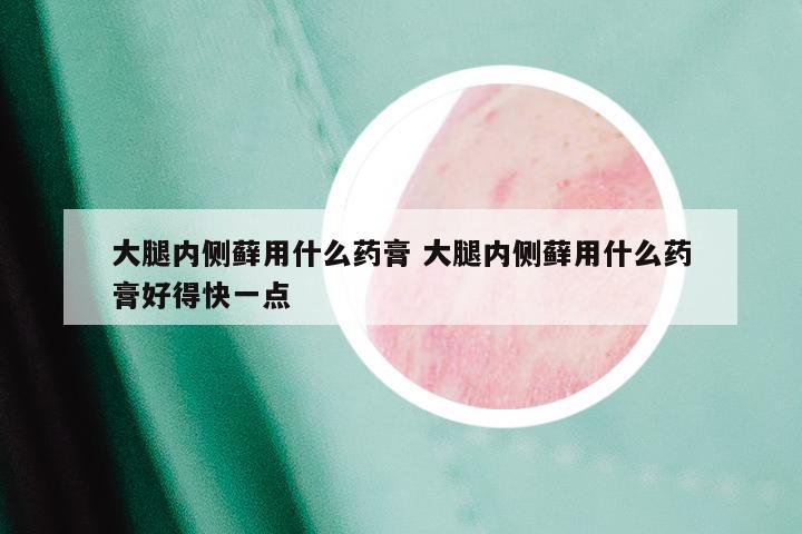 大腿内侧藓用什么药膏 大腿内侧藓用什么药膏好得快一点