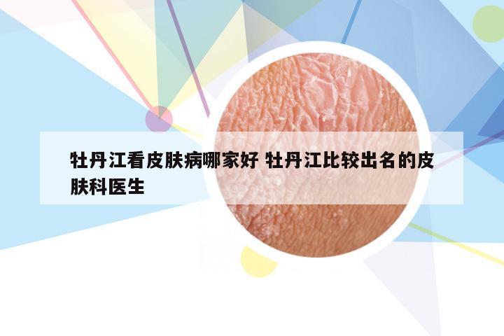 牡丹江看皮肤病哪家好 牡丹江比较出名的皮肤科医生
