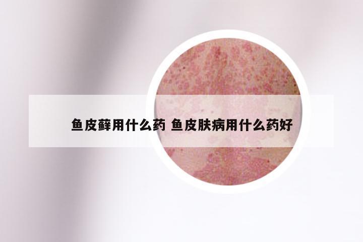 鱼皮藓用什么药 鱼皮肤病用什么药好