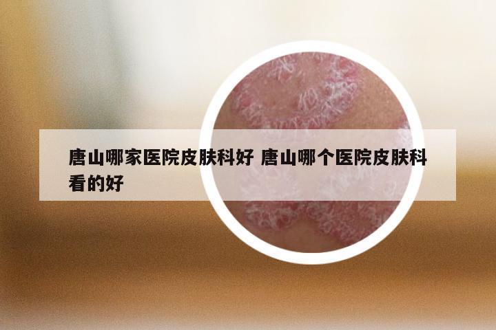 唐山哪家医院皮肤科好 唐山哪个医院皮肤科看的好