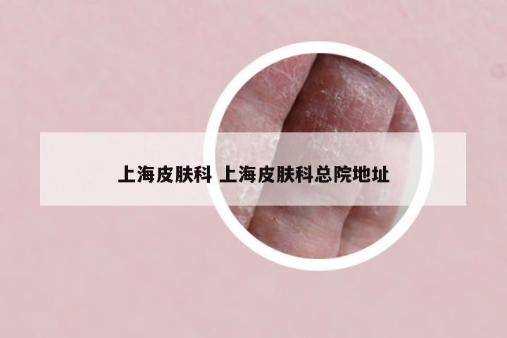 上海皮肤科 上海皮肤科总院地址