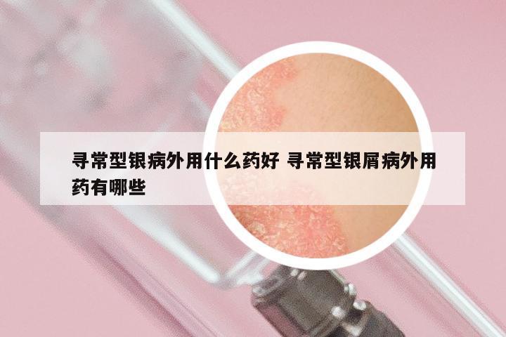寻常型银病外用什么药好 寻常型银屑病外用药有哪些