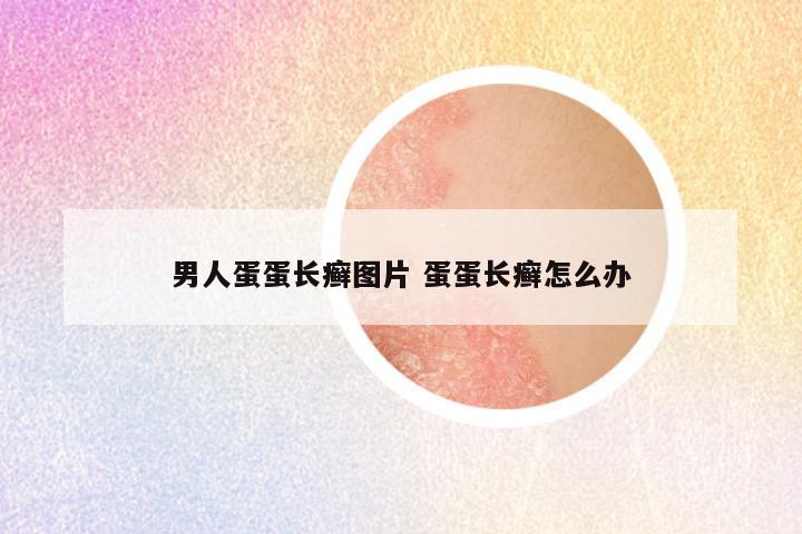 男人蛋蛋长癣图片 蛋蛋长癣怎么办