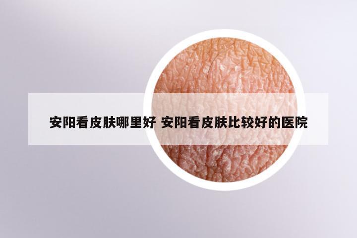 安阳看皮肤哪里好 安阳看皮肤比较好的医院