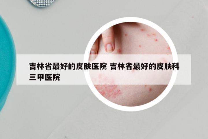 吉林省最好的皮肤医院 吉林省最好的皮肤科三甲医院