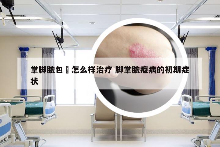 掌脚脓包廯怎么样治疗 脚掌脓疱病的初期症状