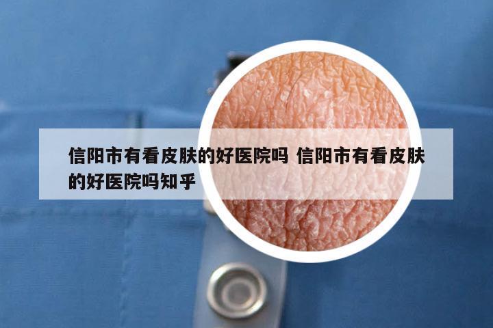 信阳市有看皮肤的好医院吗 信阳市有看皮肤的好医院吗知乎
