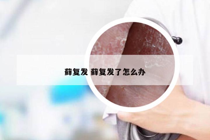 藓复发 藓复发了怎么办