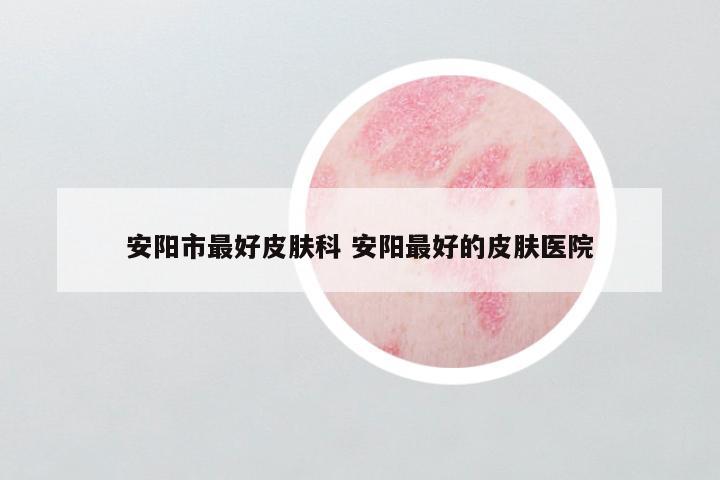 安阳市最好皮肤科 安阳最好的皮肤医院