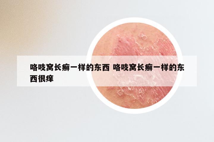 咯吱窝长癣一样的东西 咯吱窝长癣一样的东西很痒