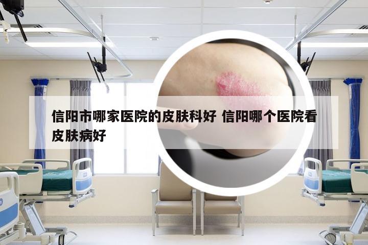 信阳市哪家医院的皮肤科好 信阳哪个医院看皮肤病好