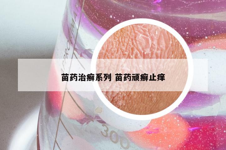 苗药治癣系列 苗药顽癣止痒