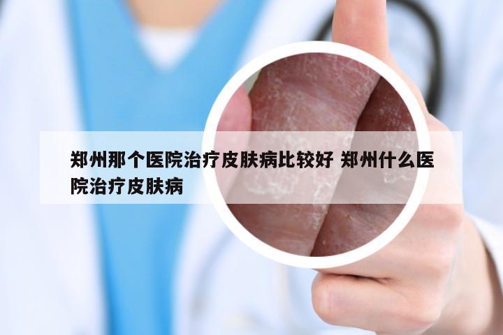 郑州那个医院治疗皮肤病比较好 郑州什么医院治疗皮肤病