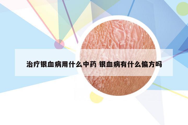 治疗银血病用什么中药 银血病有什么偏方吗