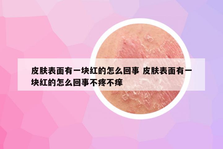 皮肤表面有一块红的怎么回事 皮肤表面有一块红的怎么回事不疼不痒