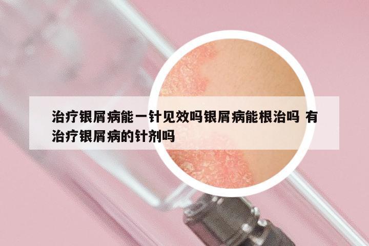 治疗银屑病能一针见效吗银屑病能根治吗 有治疗银屑病的针剂吗