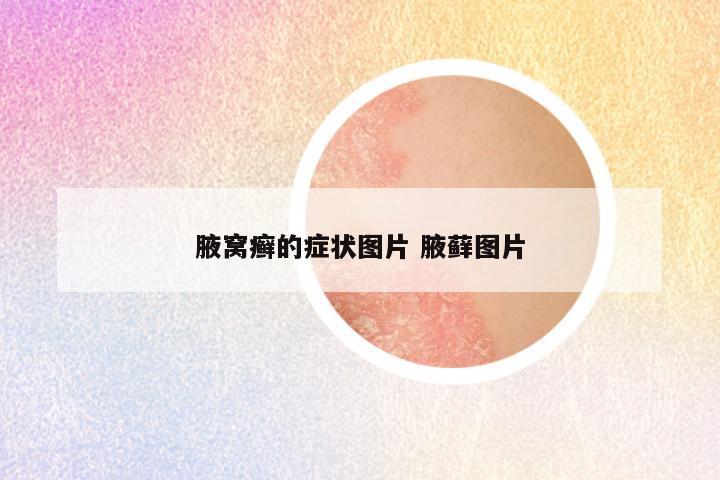 腋窝癣的症状图片 腋藓图片