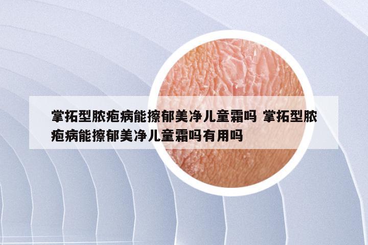 掌拓型脓疱病能擦郁美净儿童霜吗 掌拓型脓疱病能擦郁美净儿童霜吗有用吗