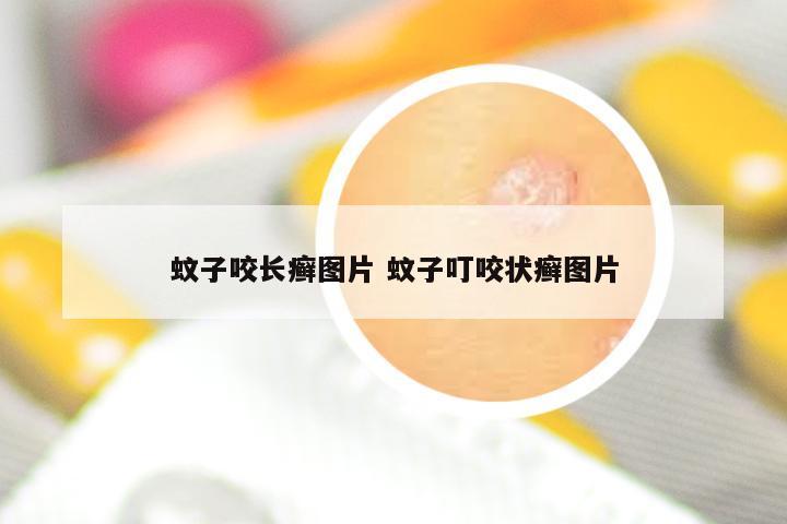 蚊子咬长癣图片 蚊子叮咬状癣图片