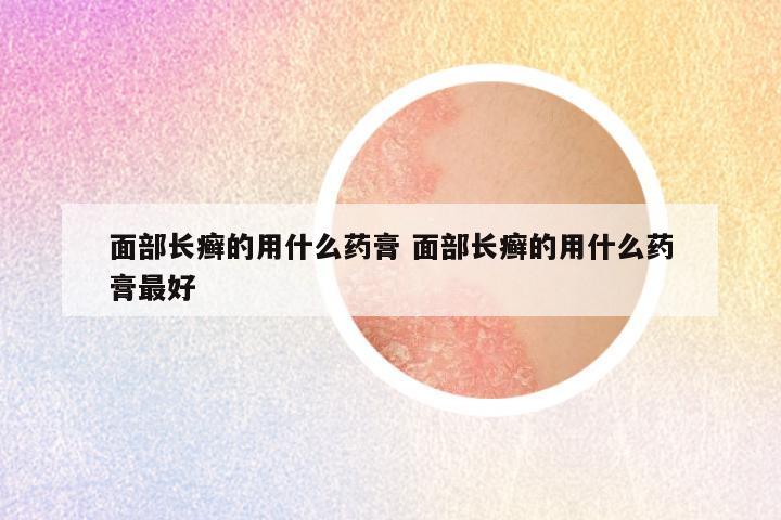 面部长癣的用什么药膏 面部长癣的用什么药膏最好