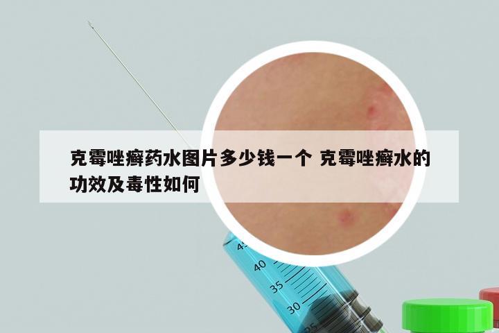 克霉唑癣药水图片多少钱一个 克霉唑癣水的功效及毒性如何