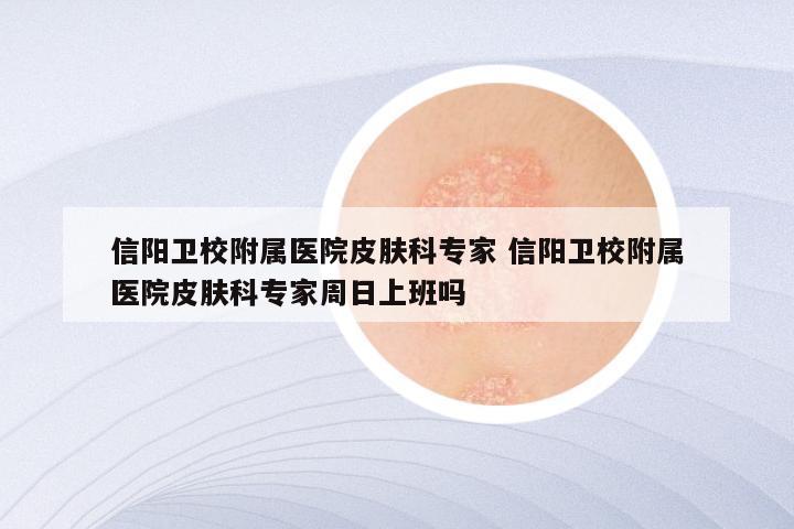 信阳卫校附属医院皮肤科专家 信阳卫校附属医院皮肤科专家周日上班吗