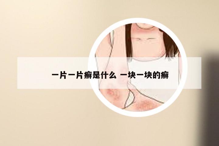 一片一片癣是什么 一块一块的癣