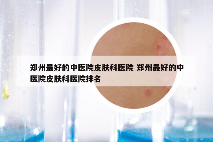 郑州最好的中医院皮肤科医院 郑州最好的中医院皮肤科医院排名