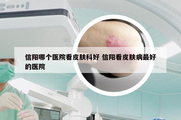 信阳哪个医院看皮肤科好 信阳看皮肤病最好的医院