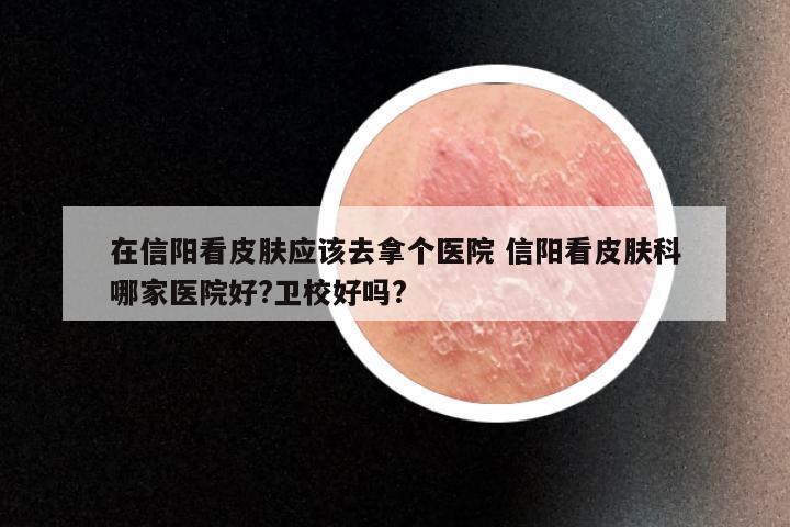 在信阳看皮肤应该去拿个医院 信阳看皮肤科哪家医院好?卫校好吗?