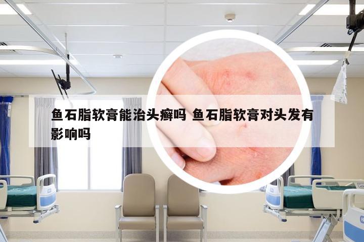 鱼石脂软膏能治头癣吗 鱼石脂软膏对头发有影响吗
