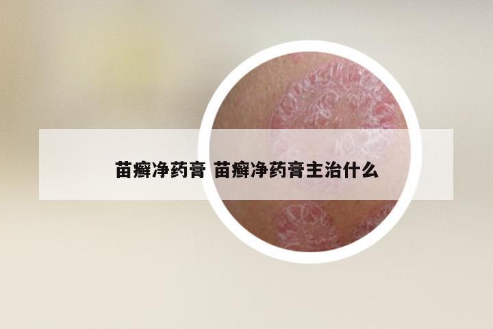 苗癣净药膏 苗癣净药膏主治什么