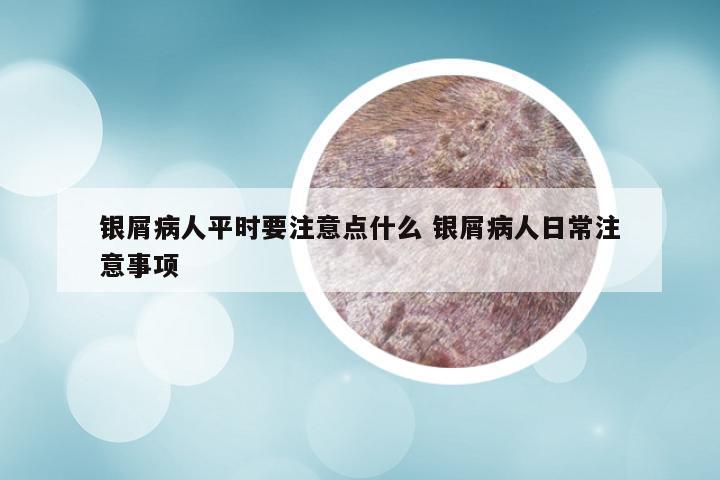 银屑病人平时要注意点什么 银屑病人日常注意事项