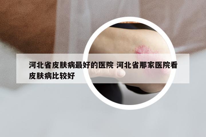 河北省皮肤病最好的医院 河北省那家医院看皮肤病比较好