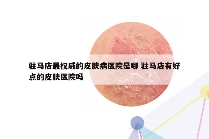 驻马店最权威的皮肤病医院是哪 驻马店有好点的皮肤医院吗