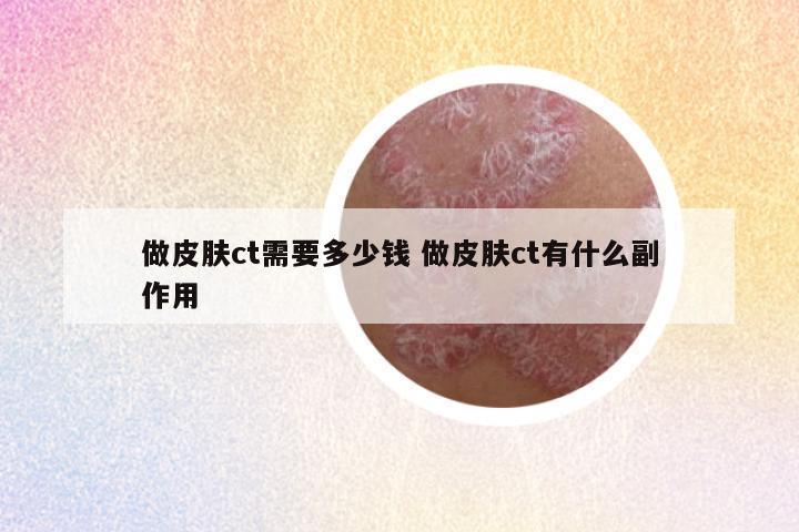 做皮肤ct需要多少钱 做皮肤ct有什么副作用