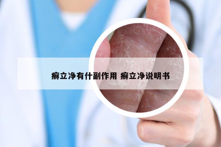 癣立净有什副作用 癣立净说明书