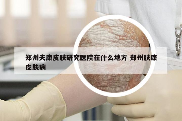 郑州夫康皮肤研究医院在什么地方 郑州肤康皮肤病