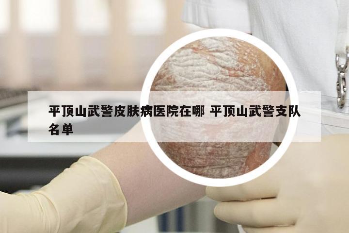 平顶山武警皮肤病医院在哪 平顶山武警支队名单