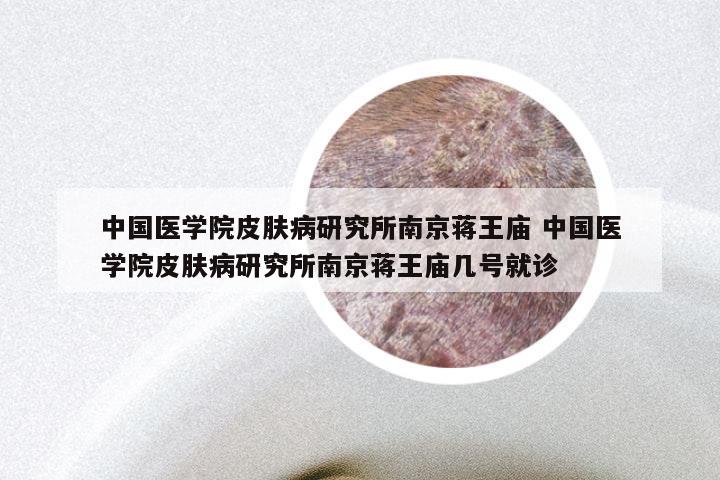 中国医学院皮肤病研究所南京蒋王庙 中国医学院皮肤病研究所南京蒋王庙几号就诊