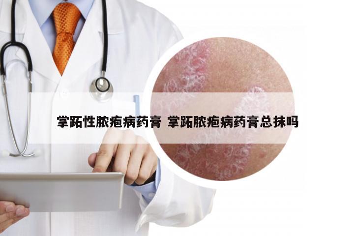 掌跖性脓疱病药膏 掌跖脓疱病药膏总抹吗
