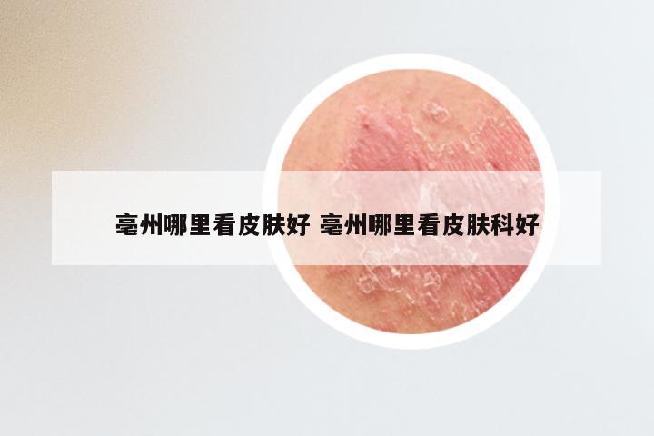 亳州哪里看皮肤好 亳州哪里看皮肤科好