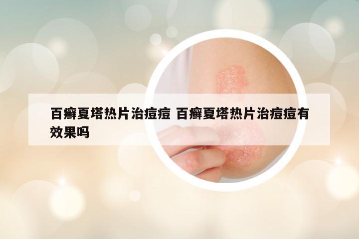 百癣夏塔热片治痘痘 百癣夏塔热片治痘痘有效果吗