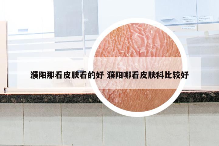 濮阳那看皮肤看的好 濮阳哪看皮肤科比较好