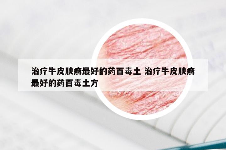 治疗牛皮肤癣最好的药百毒土 治疗牛皮肤癣最好的药百毒土方