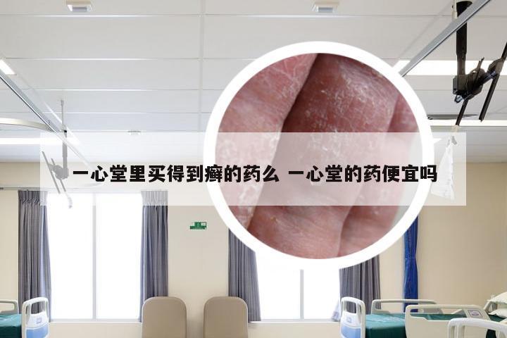 一心堂里买得到癣的药么 一心堂的药便宜吗